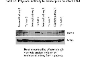 Image no. 1 for anti-Hes Family bHLH Transcription Factor 1 (HES1) (C-Term) antibody (ABIN347373) (HES1 anticorps  (C-Term))