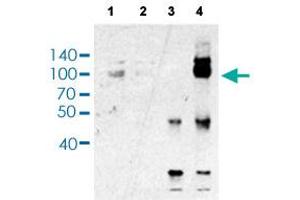 Immunoprecipitation analysis of Lane 1: 5% Input, Lane 2: 5% Sup, Lane 3: Normal IgG, and Lane 4: HNRNPUL1 ppt. (HNRNPUL1 anticorps  (AA 807-856))