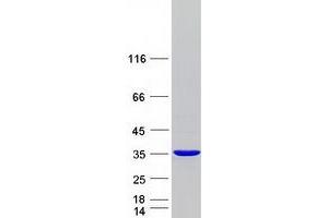 Validation with Western Blot