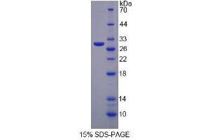 SDS-PAGE analysis of Human MPP3 Protein.