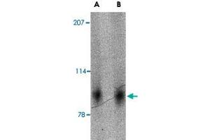 Western blot analysis of SLITRK2 in mouse brain tissue lysate with SLITRK2 polyclonal antibody  at (A) 1 and (B) 2 ug/mL .