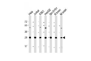 All lanes : Anti-HSD17B10 Antibody (Center) at 1:2000 dilution Lane 1: Hela whole cell lysate Lane 2: Jurkat whole cell lysate Lane 3: K562 whole cell lysate Lane 4: HepG2 whole cell lysate Lane 5: SH-SY5Y whole cell lysate Lane 6: rat brain lysate Lane 7: mouse brain lysate Lysates/proteins at 20 μg per lane. (HSD17B10 anticorps  (AA 140-172))