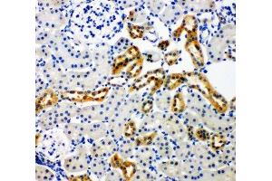 IHC-P: NOX4 antibody testing of rat kidney tissue (NADPH Oxidase 4 anticorps  (C-Term))