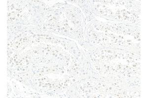 Immunohistochemistry (IHC) image for anti-Jumonji Domain Containing 6 (JMJD6) (AA 125-175) antibody (ABIN7795645)