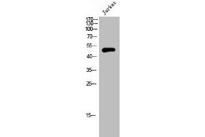 Western Blot analysis of JK cells using Septin 6 Polyclonal Antibody (Septin 6 anticorps  (Internal Region))