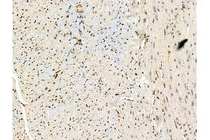 ABIN6257593 and ABIN6274990 at 1/100 staining Mouse heart tissue by IHC-P.