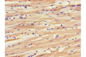 IHC image of ABIN7143542 diluted at 1:1200 and staining in paraffin-embedded human heart tissue performed on a Leica BondTM system. (SLC25A6 anticorps  (AA 144-175))