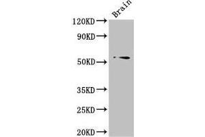 Western Blot Positive WB detected in: Mouse brain tissue All lanes: TRIM43 antibody at 3 μg/mL Secondary Goat polyclonal to rabbit IgG at 1/50000 dilution Predicted band size: 53 kDa Observed band size: 53 kDa (TRIM43 anticorps  (AA 43-240))