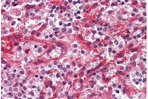 Human Spleen, Red Pulp (formalin-fixed, paraffin-embedded) stained with DARC antibody ABIN337034 at 2. (DARC anticorps  (C-Term))