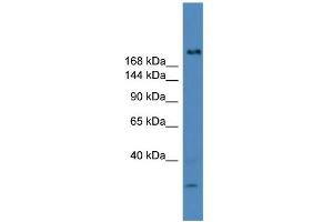 WB Suggested Anti-USP9Y Antibody Titration: 0.