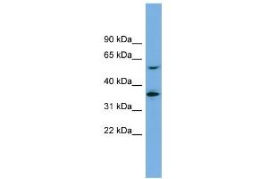 WB Suggested Anti-SLC7A7 Antibody Titration:  0. (SLC7A7 anticorps  (Middle Region))