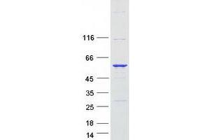 Validation with Western Blot