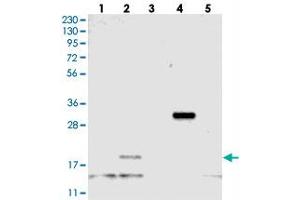 Western blot analysis of Lane 1: RT-4, Lane 2: U-251 MG, Lane 3: Human Plasma, Lane 4: Liver, Lane 5: Tonsil with C21orf57 polyclonal antibody .