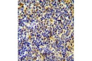Immunohistochemistry analysis in formalin fixed and paraffin embedded human tonsil tissue using IKZF1/IKAROS Antibody (C-term), followed by peroxidase conjugation of the secondary antibody and DAB staining. (IKZF1 anticorps  (C-Term))