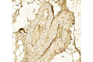 Immunohistochemical analysis of paraffin-embedded Human Skeletal muscle section using Pink1 (ABIN6242381 and ABIN6577241).