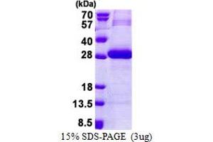 SDS-PAGE (SDS) image for Protease, serine, 3 (PRSS3) (AA 81-304) protein (His tag) (ABIN5853148) (PRSS3 Protein (AA 81-304) (His tag))