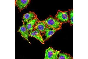 Immunofluorescence analysis of HepG2 cells using Rab6b mouse mAb (green).