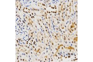 Immunohistochemistry of paraffin-embedded rat kidney tissue using Histone H3 antibody at dilution of 1:200 (x400 lens). (Histone 3 anticorps  (C-Term))