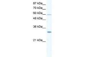 DDX31 antibody used at 2. (DDX31 anticorps)