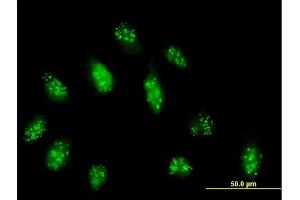 Immunofluorescence of purified MaxPab antibody to CENPB on HeLa cell. (CENPB anticorps  (AA 1-599))
