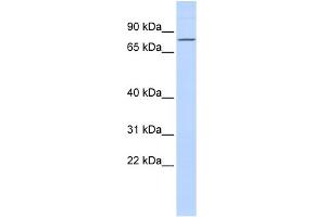 WB Suggested Anti-ZNF354A Antibody Titration:  0. (ZNF354A anticorps  (Middle Region))