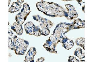 IHC analysis of MCM6 using anti-MCM6 antibody (ABIN7600038).