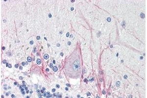 Human Brain, Cerebellum (formalin-fixed, paraffin-embedded) stained with DNASE2 antibody ABIN214485 at 5 ug/ml followed by biotinylated goat anti-rabbit IgG secondary antibody ABIN481713, alkaline phosphatase-streptavidin and chromogen. (DNASE2 anticorps  (AA 347-360))
