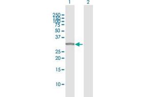 Western Blot analysis of SULT1A1 expression in transfected 293T cell line by SULT1A1 MaxPab polyclonal antibody.