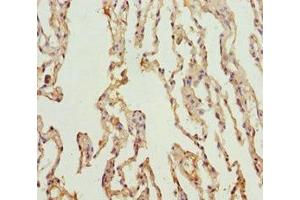 Immunohistochemistry of paraffin-embedded human lung tissue using ABIN7164013 at dilution of 1:100 (KCNS3 anticorps  (AA 1-180))