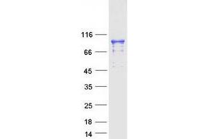 Validation with Western Blot