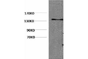 Western blot analysis of Hela, diluted at 1:1000. (HSV Tag anticorps)