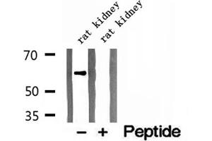 Western blot analysis of extracts of rat kidney tissue, using CKAP4 antibody. (CKAP4 anticorps  (C-Term))