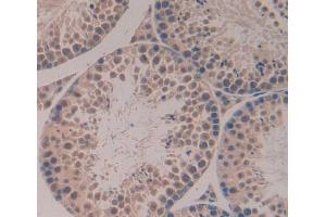 Used in DAB staining on fromalin fixed paraffin- embedded testis tissue