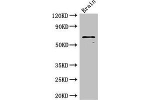 Western Blot Positive WB detected in: Mouse brain tissue All lanes: SLC6A3 antibody at 3 μg/mL Secondary Goat polyclonal to rabbit IgG at 1/50000 dilution Predicted band size: 69 kDa Observed band size: 69 kDa (SLC6A3 anticorps  (AA 161-237))