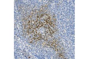 anti-Natural Cytotoxicity Triggering Receptor 1 (NCR1) (AA 22-258) antibody