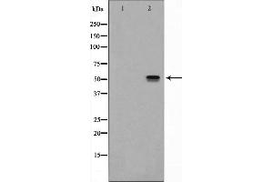 Western blot analysis of NK1R expression in Mouse lung lysate The lane on the left is treated with the antigen-specific peptide. (TACR1 anticorps  (Internal Region))