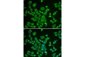 Immunofluorescence analysis of HeLa cells using SMAD1 antibody. (SMAD1 anticorps  (AA 20-240))