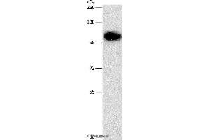 Western blot analysis of Mouse brain tissue, using DNM3 Polyclonal Antibody at dilution of 1:500 (Dynamin 3 anticorps)
