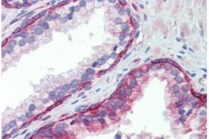Human Prostate (formalin-fixed, paraffin-embedded) stained with UBE2L3 antibody ABIN462238 followed by biotinylated goat anti-rabbit IgG secondary antibody ABIN481713, alkaline phosphatase-streptavidin and chromogen. (UBE2L3 anticorps  (C-Term))