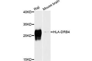 Western blot analysis of extracts of various cell lines, using HLA-DRB4 antibody (ABIN4903935) at 1:1000 dilution. (HLA-DRB4 anticorps)