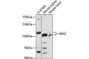 Western blot analysis of extracts of various cell lines, using GB antibody (ABIN6131314, ABIN6140988, ABIN6140989 and ABIN6216604) at 1:3000 dilution. (GBA2 anticorps  (AA 708-927))