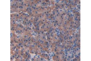 Used in DAB staining on fromalin fixed paraffin- embedded Kidney tissue (pPLA2 anticorps  (AA 16-148))