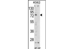 Western blot analysis of FLCN Antibody (C-term) Pab (ABIN652601 and ABIN2842403) pre-incubated without(lane 1) and with(lane 2) blocking peptide in K562 cell line lysate. (FLCN anticorps  (C-Term))
