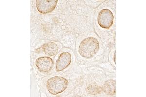 Immunohistochemistry (IHC) image for anti-Torsin A Interacting Protein 1 (TOR1AIP1) (AA 275-325) antibody (ABIN7454431)