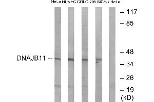 Immunohistochemistry analysis of paraffin-embedded human heart tissue using DNAJB11 antibody.
