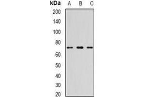 Western blot analysis of TTLL12 expression in NIH3T3 (A), mouse thymus (B), mouse heart (C) whole cell lysates. (TTLL12 anticorps)