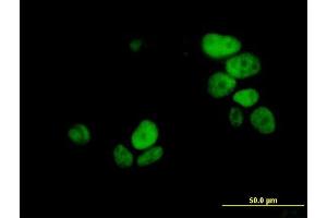 Immunofluorescence of monoclonal antibody to UHRF1 on MCF-7 cell. (UHRF1 anticorps  (AA 694-793))