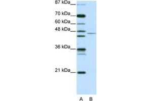 Western Blotting (WB) image for anti-Tripartite Motif Containing 14 (TRIM14) antibody (ABIN2461040) (TRIM14 anticorps)