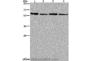 Western blot analysis of Mouse kidney, liver, heart and brain tissue, using ART4 Polyclonal Antibody at dilution of 1:667 (ART4 anticorps)