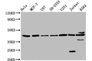 Western Blot Positive WB detected in: Hela whole cell lysate, MCF-7 whole cell lysate, U87 whole cell lysate, SH-SY5Y whole cell lysate, U251 whole cell lysate, Jurkat whole cell lysate, K562 whole cell lysate All lanes: NPY2R antibody at 3. (NPY2R anticorps  (AA 326-381))